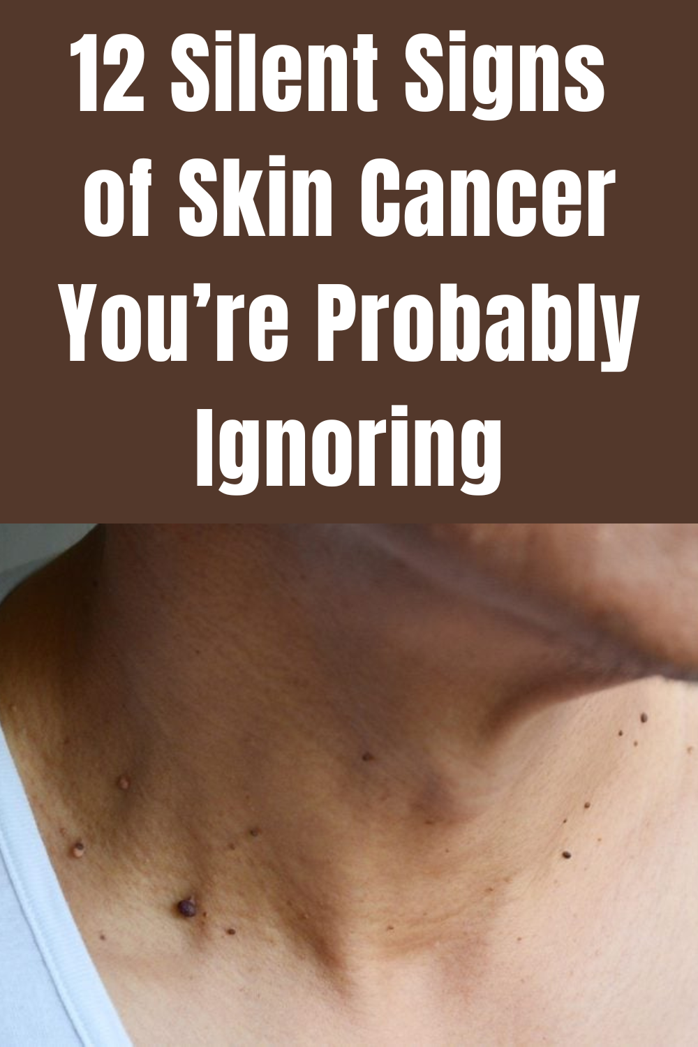 12 Silent Signs Of Skin Cancer You’re Probably Ignoring - Daily 