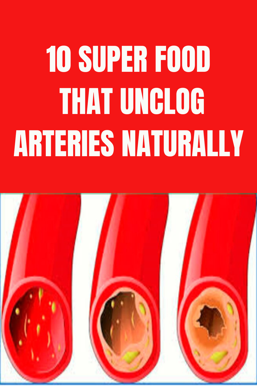 Health 10 Super Food that Unclog Arteries Naturally - Daily Gardening Mag