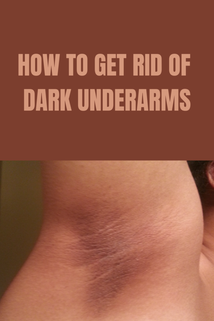 How To Get Rid Of Dark Underarms With Toothpaste How To Get Rid of Dark Underarms - Daily Gardening Mag