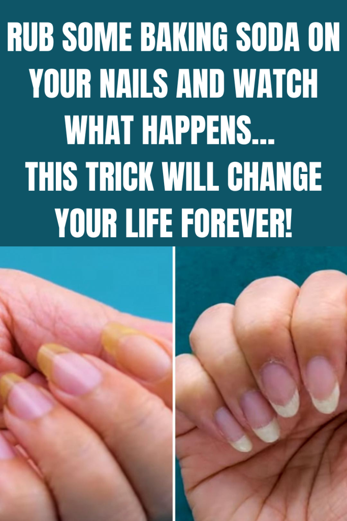 Rub Some Baking Soda On Your Nails And Watch What Happens… This Trick Will Change Your Life Forever!