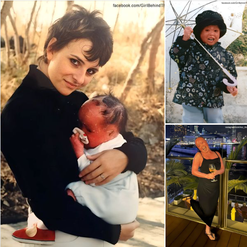 Couple Adopt Abandoned Red-Skinned Baby Predicted to Die Young, Raise Her into a Successful Woman