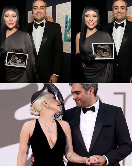Lady Gaga Joyfully Shares The Exciting News That She’s Expecting Her First Baby With Her Fiancé, Businessman Michael Polansky! Right After The Announcement Was Made Public, Hundreds Of Thousands Of Fans Flooded The Internet With Congratulations, Sharing In The Happiness Of The Bold And Iconic Star. And What Made It Even More Special — Lady Gaga Also Revealed The Baby’s Gender